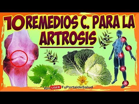 ¿Qué planta es buena para la artrosis? 6