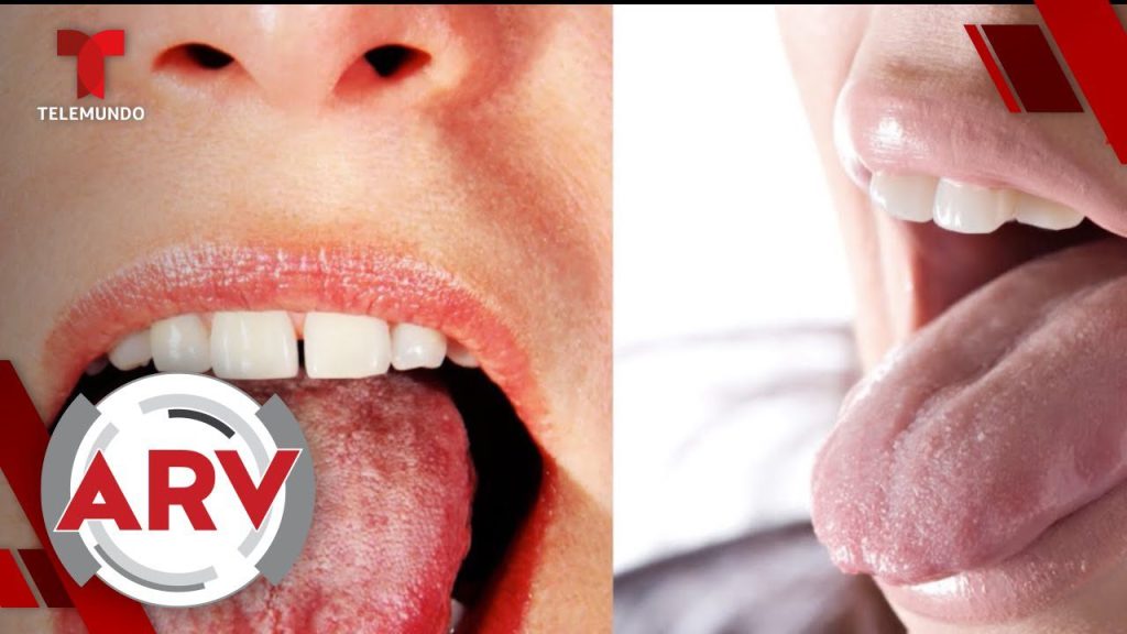 ¿Qué enfermedades se pueden ver en la lengua? 4